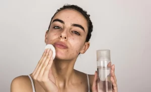 Quy trình skincare cho da dầu mụn buổi sáng