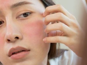 Nguyên tắc chăm sóc da nhạy cảm không gây kích ứng