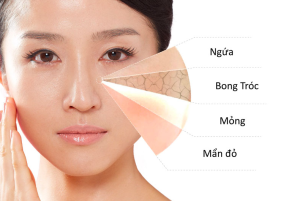 Cách chăm sóc da nhạy cảm không kích ứng hàng ngày